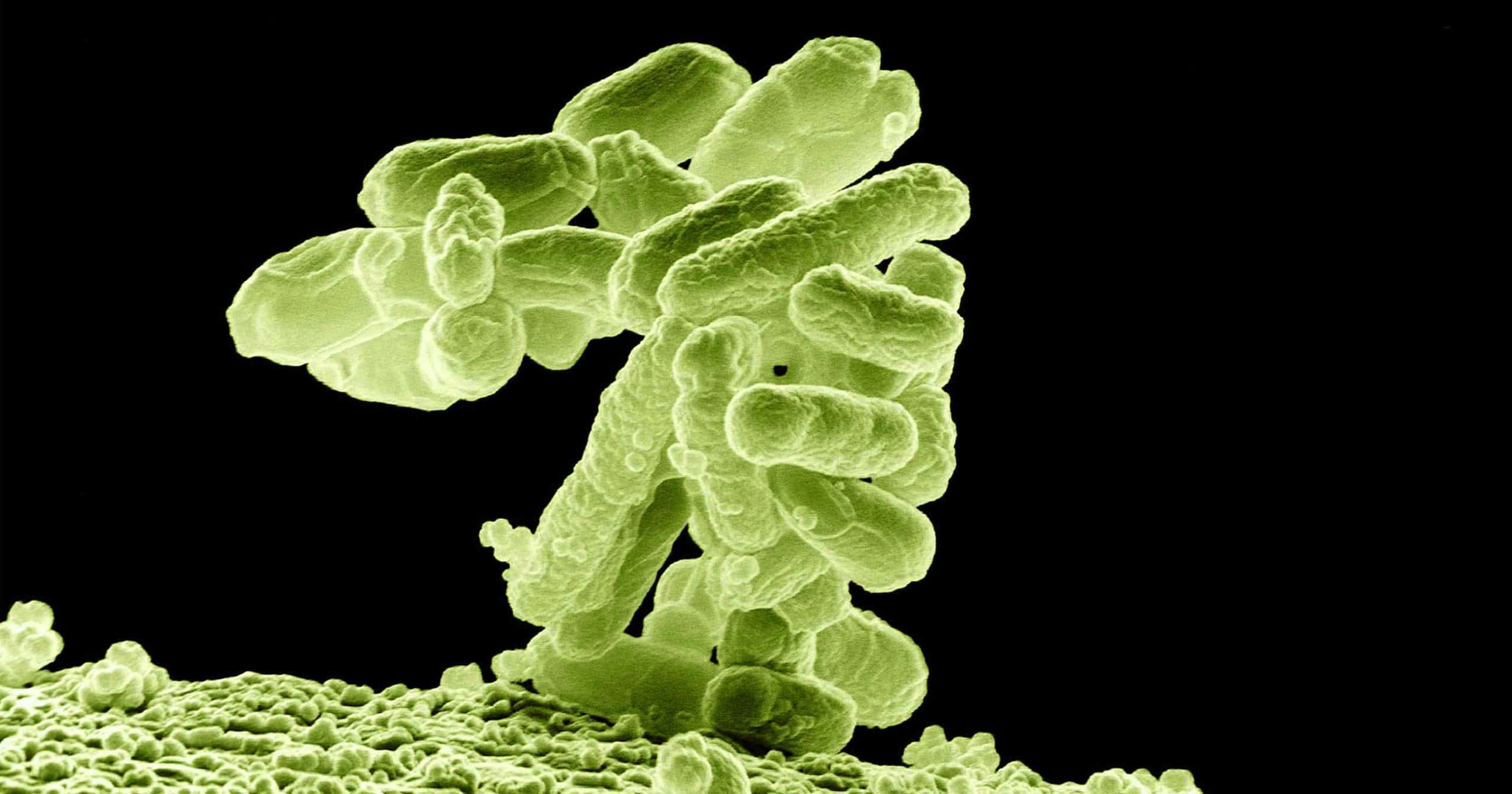 Pseudomonas Bacteria Control