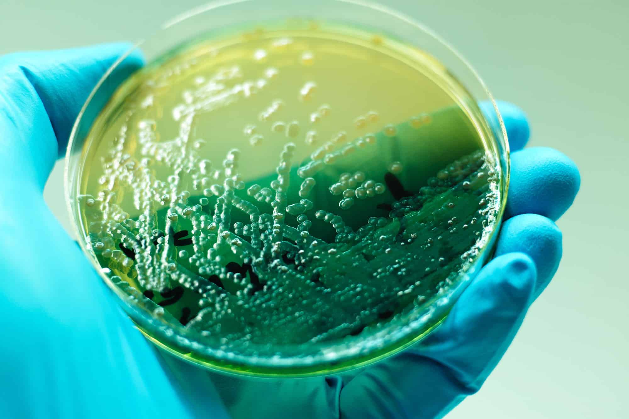 Petrie Dish in a Lab